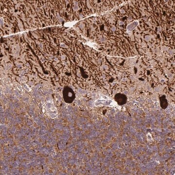 Anti-METTL17 antibody produced in rabbit Prestige Antibodies&#174; Powered by Atlas Antibodies, affinity isolated antibody, buffered aqueous glycerol solution