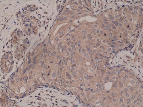 Anti-SMAD4 antibody, Rabbit monoclonal recombinant, expressed in HEK 293 cells, clone RM277, purified immunoglobulin