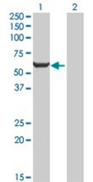 抗GPI抗体 マウス宿主抗体 IgG fraction of antiserum, buffered aqueous solution