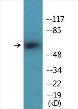 Anti-phospho-Chk2 (pThr387) antibody produced in rabbit affinity isolated antibody