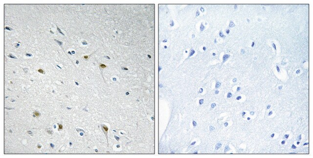 Anti-CDC25C antibody produced in rabbit affinity isolated antibody