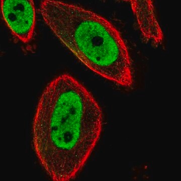 Anty-FOXP3 Prestige Antibodies&#174; Powered by Atlas Antibodies, affinity isolated antibody