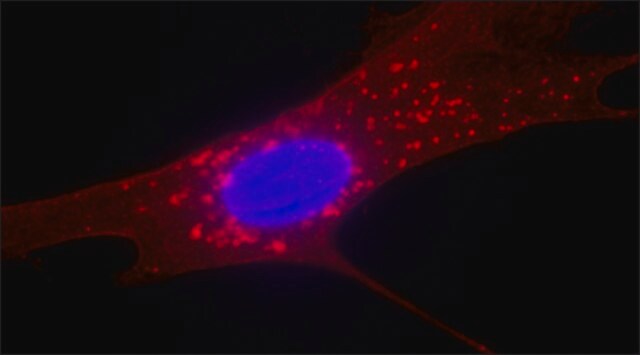 Przeciwciało przeciwko białku powierzchniowemu fibroblastów, mysie monoklonalne clone 1B10, purified from hybridoma cell culture