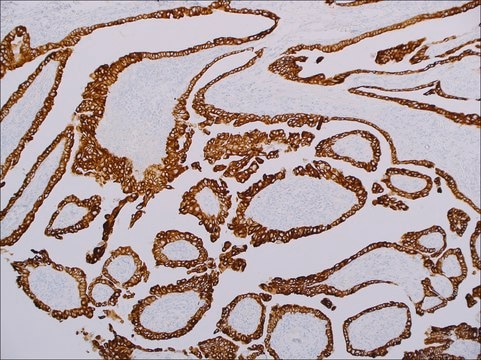 Cytokeratin 19 (EP72) Rabbit Monoclonal Primary Antibody