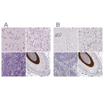 Anty-KRT25 Prestige Antibodies&#174; Powered by Atlas Antibodies, affinity isolated antibody