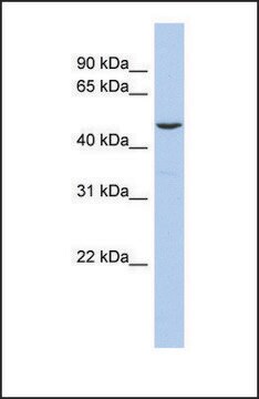 Anti-FLI1 antibody produced in rabbit affinity isolated antibody