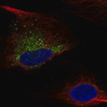 Anti-COL1A1 antibody produced in rabbit Prestige Antibodies&#174; Powered by Atlas Antibodies, affinity isolated antibody, buffered aqueous glycerol solution