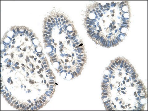 Anti-NR0B1 antibody produced in rabbit IgG fraction of antiserum