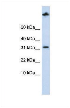 Anti-SCP2 antibody produced in rabbit affinity isolated antibody