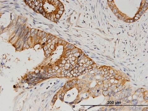 Monoclonal Anti-SERBP1 antibody produced in mouse clone 1G5-2D7, purified immunoglobulin, buffered aqueous solution