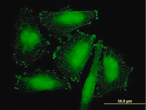 Anti-SORBS2 antibody produced in mouse purified immunoglobulin, buffered aqueous solution