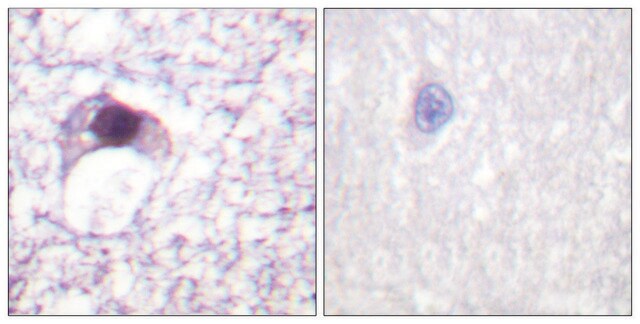 Anti-E2F6 antibody produced in rabbit affinity isolated antibody