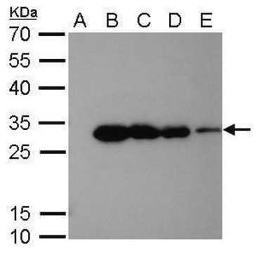 单克隆抗 6X His 标签 小鼠抗 clone GT161, affinity isolated antibody