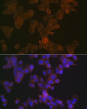 Anti-APOL1 antibody produced in rabbit