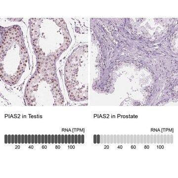 Anti-PIAS2 antibody produced in rabbit Prestige Antibodies&#174; Powered by Atlas Antibodies, affinity isolated antibody, buffered aqueous glycerol solution