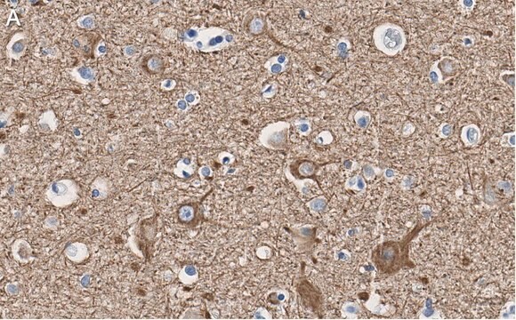 Anti-Neurofilament L Antibody, clone 1E13 ZooMAb&#174; Rabbit Monoclonal recombinant, expressed in HEK 293 cells