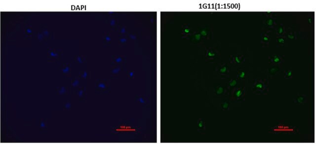 Anti-EZHIP Antibody, clone 1G11