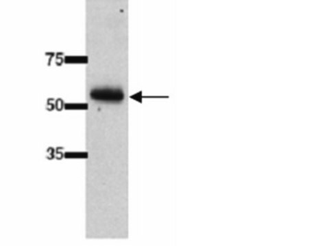 Przeciwciało anty-UGT2B7 (rodzina UDP-glikozylotransferaz 2B, polipeptyd 7) serum, Chemicon&#174;