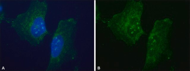 抗-多巴胺转运蛋白（N端） 兔抗 ~1.0&#160;mg/mL, affinity isolated antibody, buffered aqueous solution