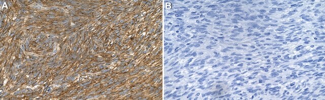 Anti-c-Kit/CD117 Antibody, clone 1I8 ZooMAb&#174; Rabbit Monoclonal recombinant, expressed in HEK 293 cells