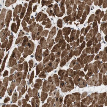 Anti-SLC41A1 antibody produced in rabbit Prestige Antibodies&#174; Powered by Atlas Antibodies, affinity isolated antibody, buffered aqueous glycerol solution