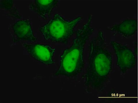 Monoclonal Anti-PPP3R1 antibody produced in mouse clone 4E1, purified immunoglobulin, buffered aqueous solution