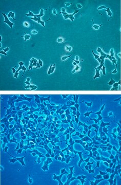 Lignée cellulaire d'insulinome de rat INS-1&nbsp;832/3 INS-1 832/3 rat insulinoma cell line is a useful model for insulin secretion regulation and pancreatic islet beta-cell function studies.