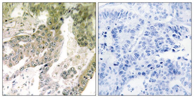 Anti-LAMA5 antibody produced in rabbit affinity isolated antibody