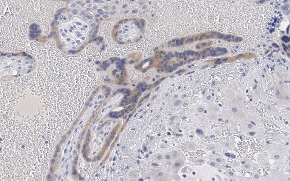 Anti-Angiopoietin-2 Antibody, clone 4L18 ZooMAb&#174; Rabbit Monoclonal recombinant, expressed in HEK 293 cells