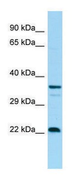 Anti-CD83 (C-terminal) antibody produced in rabbit affinity isolated antibody