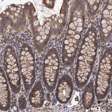 Anti-LRRC2 antibody produced in rabbit Prestige Antibodies&#174; Powered by Atlas Antibodies, affinity isolated antibody, buffered aqueous glycerol solution