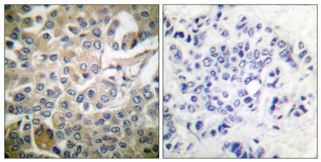 Anti-RAC1 antibody produced in rabbit affinity isolated antibody