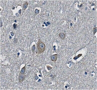 Anti-NB thymosin beta (TMSB15A Antibody), Clone 4A6.3 clone 4A6.3, from mouse