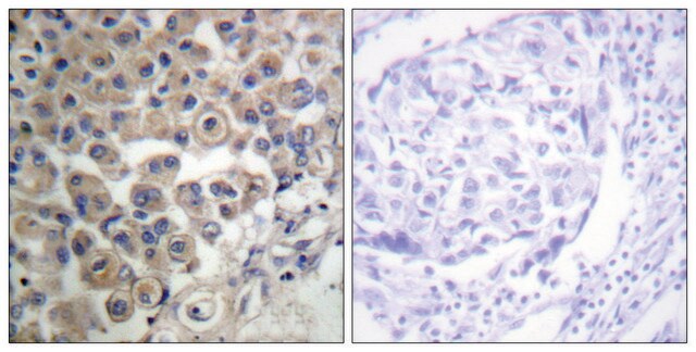 Anti-PLC &#946;3 antibody produced in rabbit affinity isolated antibody