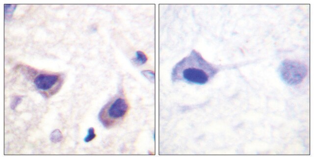 Anti-JAK3 antibody produced in rabbit affinity isolated antibody