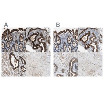 Anti-FLNB antibody produced in rabbit Prestige Antibodies&#174; Powered by Atlas Antibodies, affinity isolated antibody, buffered aqueous glycerol solution