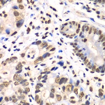 Anti-RBBP7 antibody produced in rabbit