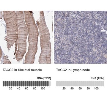 Anti-TACC2 antibody produced in rabbit Prestige Antibodies&#174; Powered by Atlas Antibodies, affinity isolated antibody, buffered aqueous glycerol solution