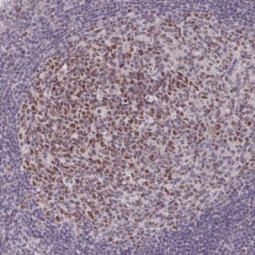 Anti-MLH1 antibody produced in rabbit Prestige Antibodies&#174; Powered by Atlas Antibodies, affinity isolated antibody, buffered aqueous glycerol solution