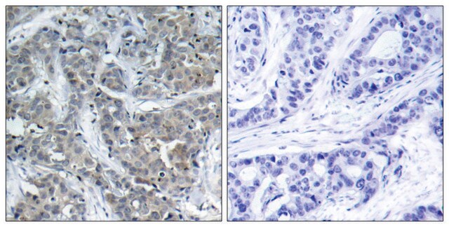 Anti-Stathmin 1 antibody produced in rabbit affinity isolated antibody