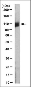 Anti-Mineralocorticoid Receptor Antibody, clone 2D6 clone 2D6, from mouse