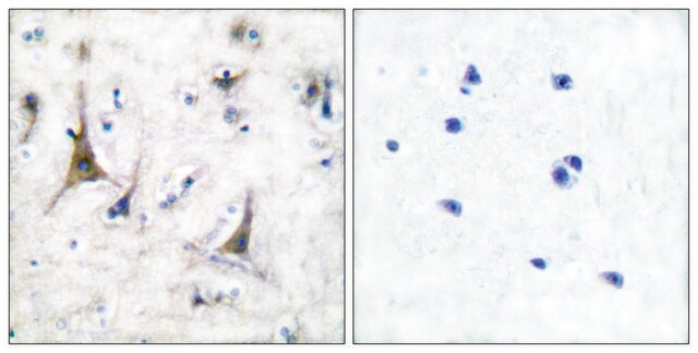 抗-PGP9.5 兔抗 affinity isolated antibody