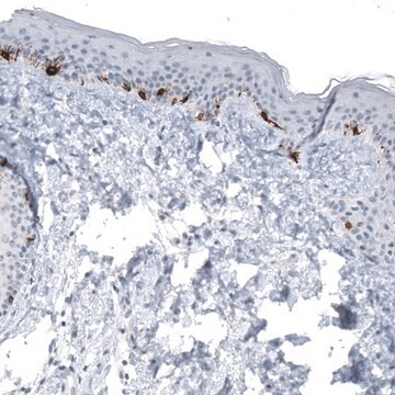 Monoclonal Anti-TYRP1 antibody produced in mouse Prestige Antibodies&#174; Powered by Atlas Antibodies, clone CL4923, purified immunoglobulin, buffered aqueous glycerol solution