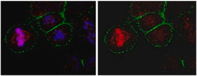 Anti-CKAP5 Antibody from rabbit, purified by affinity chromatography