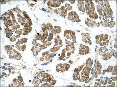 抗RHOT1抗体 ウサギ宿主抗体 affinity isolated antibody