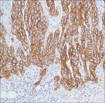 Anti-C-ERBB-2/HER-2 antibody, Rabbit monoclonal recombinant, expressed in proprietary host, clone SP3, tissue culture supernatant