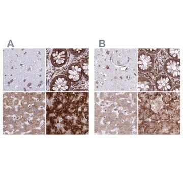 Anti-RPS15 antibody produced in rabbit Prestige Antibodies&#174; Powered by Atlas Antibodies, affinity isolated antibody, buffered aqueous glycerol solution