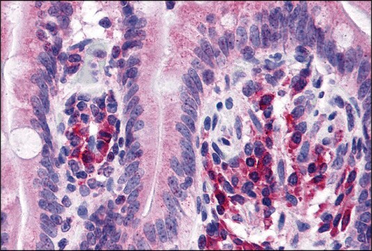 Anti-ANKRD27 antibody produced in rabbit affinity isolated antibody