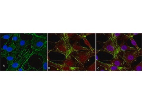 Anticorpo anti-fosfo-Akt (Thr308), clone 50-1C-25, monoclonale di coniglio clone NL50, Upstate&#174;, from rabbit