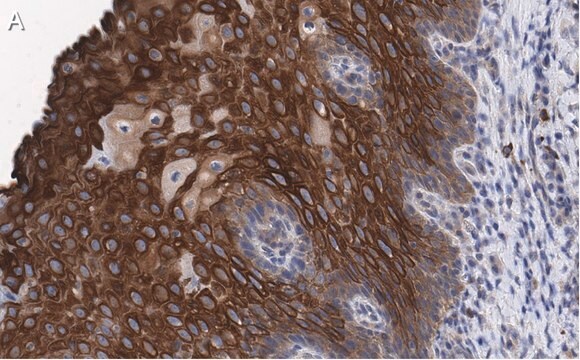 抗Lアミノ酸オキシダーゼ抗体 クローン4O11 ZooMAb&#174;ウサギモノクローナル recombinant, expressed in HEK 293 cells